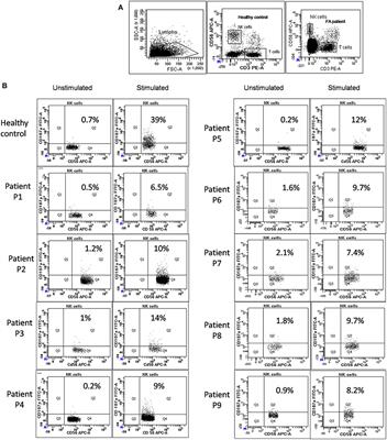 Natural Killer Cell Degranulation Defect: A Cause for Impaired NK-Cell Cytotoxicity and Hyperinflammation in Fanconi Anemia Patients